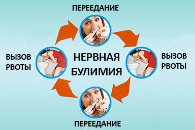 Лечение булимии в Криводановке